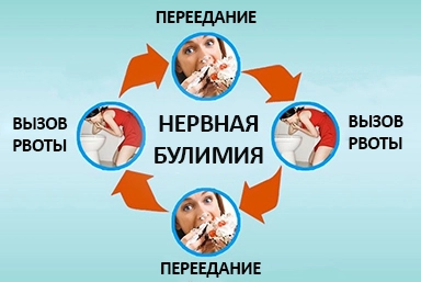 Лечение булимии в Верхних Ачалуках